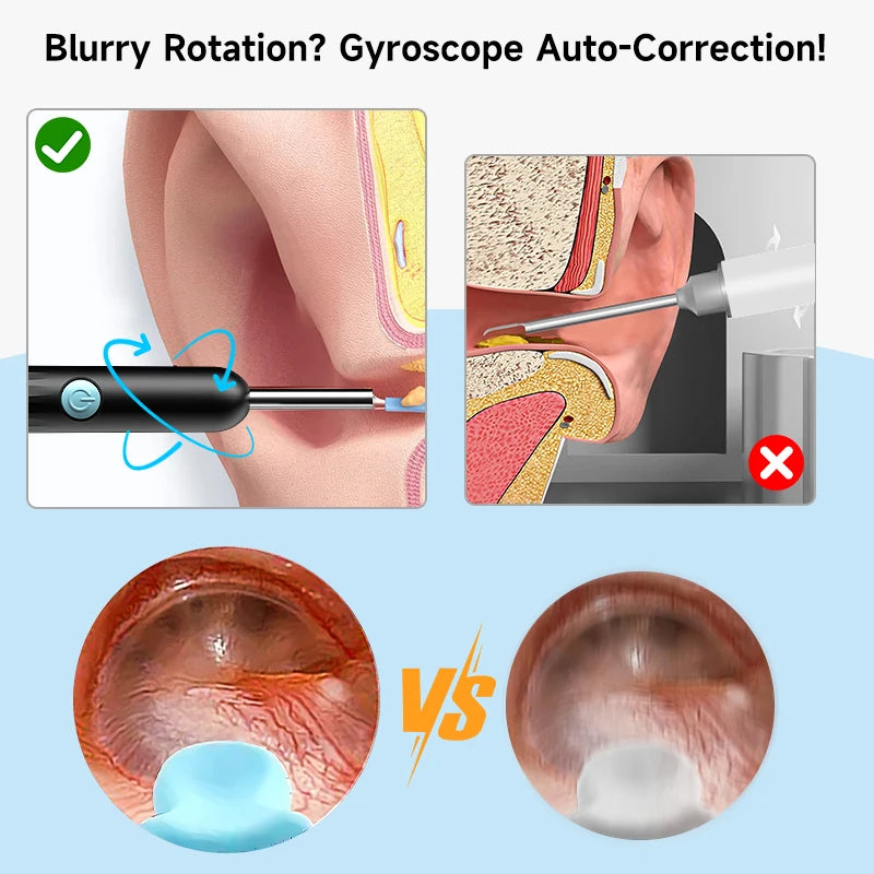 4.2MM Visual Ear Scope 1080P HD Otoscope Endoscope Ear Picker Camera for iPhone/Android Ear Wax Removal Kit for Ear Cleaning