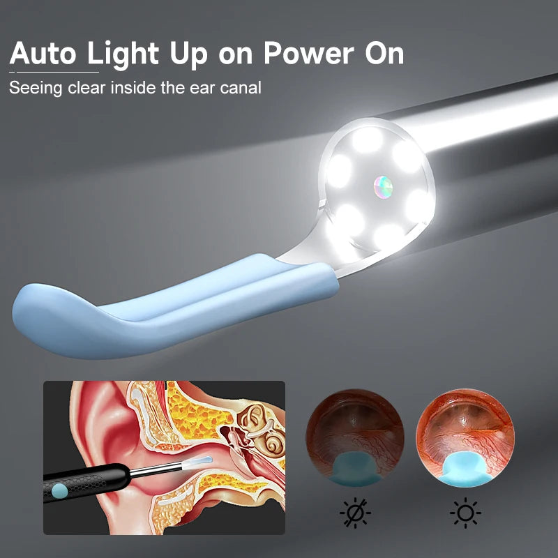4.2MM Visual Ear Scope 1080P HD Otoscope Endoscope Ear Picker Camera for iPhone/Android Ear Wax Removal Kit for Ear Cleaning