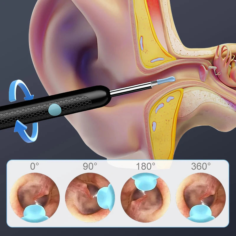 4.2MM Visual Ear Scope 1080P HD Otoscope Endoscope Ear Picker Camera for iPhone/Android Ear Wax Removal Kit for Ear Cleaning