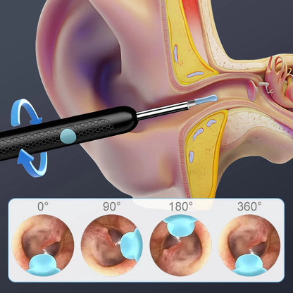 4.2MM Visual Ear Scope 1080P HD Otoscope Endoscope Ear Picker Camera for iPhone/Android Ear Wax Removal Kit for Ear Cleaning